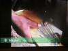video of thumb piano